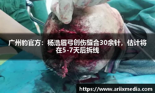 广州豹官方：杨浩眉弓创伤缝合30余针，估计将在5-7天后拆线